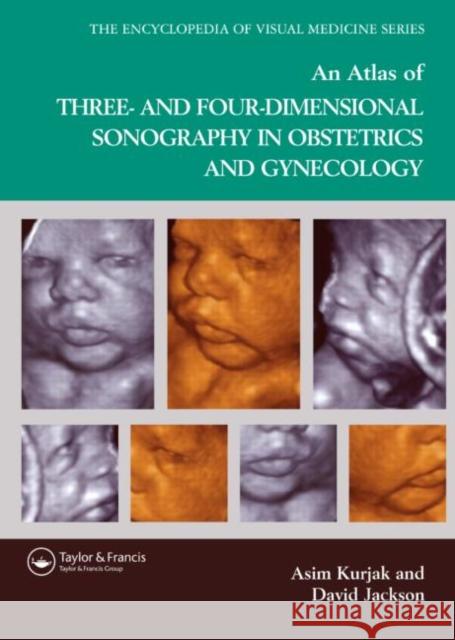 An Atlas of Three- And Four-Dimensional Sonography in Obstetrics and Gynecology Jackson, David 9781842142387 Taylor & Francis Group