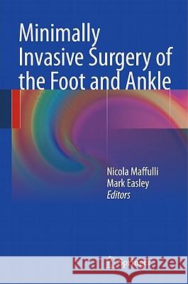 Minimally Invasive Surgery of the Foot and Ankle Mark Easley Nicola Maffulli 9781849964166 Springer
