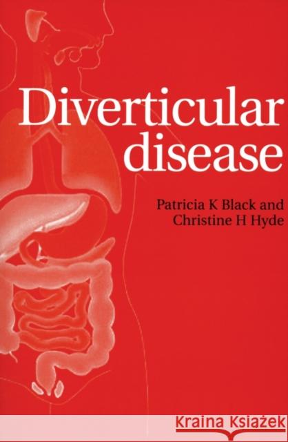 Diverticular Disease Patricia Black Christine Hyde Pat Black 9781861564467 John Wiley & Sons