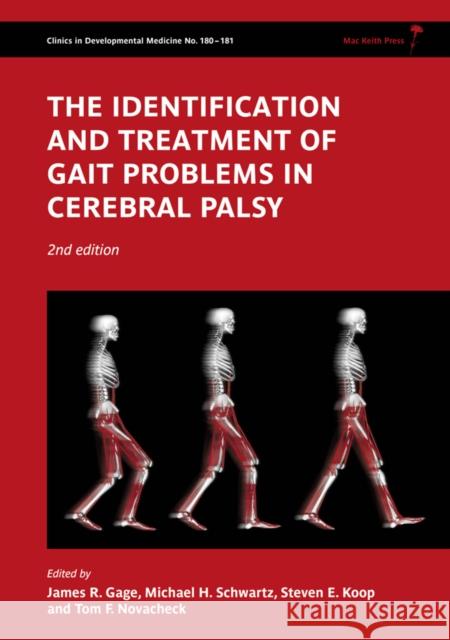 The Identification and Treatment of Gait Problems in Cerebral Palsy [With 2 Dvdroms] Gage, James R. 9781898683650 Mac Keith Press