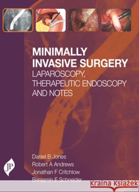 Minimally Invasive Surgery Daniel.B Jones 9781907816192