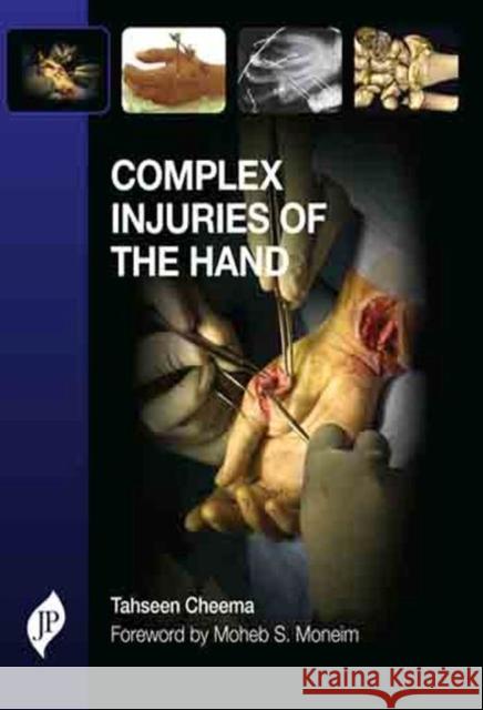 Complex Injuries of the Hand Tahseen Cheema   9781907816253 JP Medical Ltd