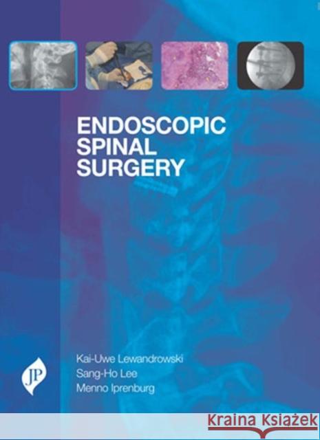 Endoscopic Spinal Surgery Kai-Uwe Lewandrowski Sang Ho Lee Menno Iprenburg 9781907816277 JP Medical Ltd