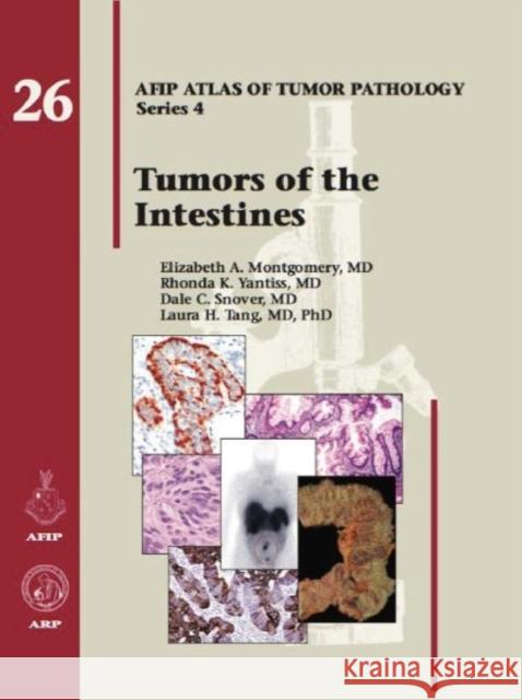 Tumors of the Intestines  Montgomery, Elizabeth A.|||Yantiss, Rhonda K.|||Snover, Dale C. 9781933477398