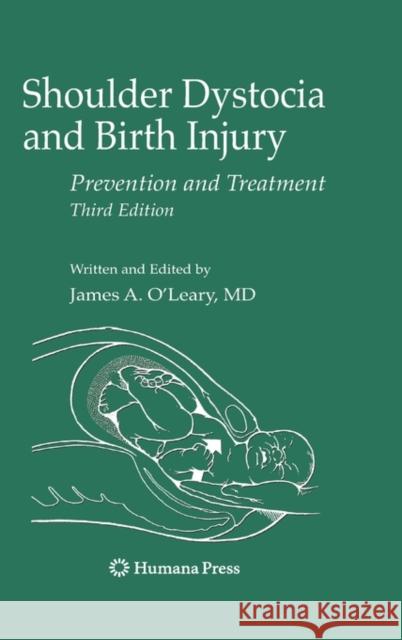 Shoulder Dystocia and Birth Injury: Prevention and Treatment O'Leary, James A. 9781934115282 Humana Press