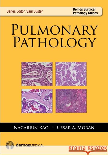 Pulmonary Pathology Rao R. Nagarjun 9781936287345 Demos Medical Publishing