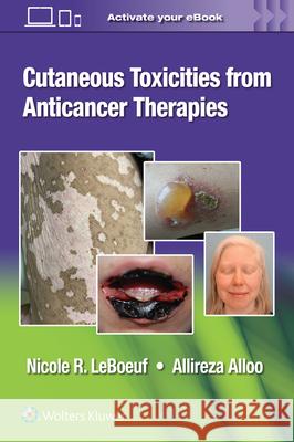 Cutaneous Reactions from Anti-Cancer Therapies Alloo, Allireza 9781975157890 Wolters Kluwer Health