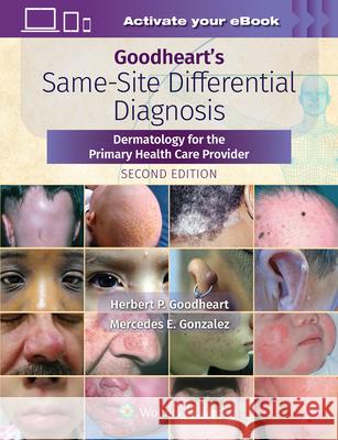 Goodheart's Same-Site Differential Diagnosis: Dermatology for the Primary Health Care Provider Herbert Goodheart 9781975161330 Wolters Kluwer Health