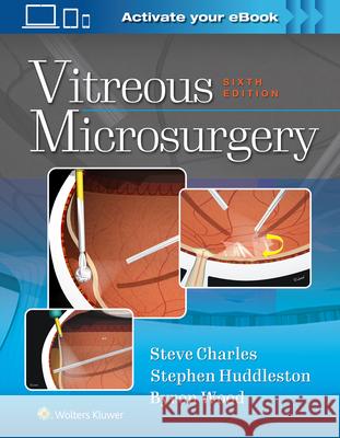 Vitreous Microsurgery Steve Charles   9781975168353 Wolters Kluwer Health