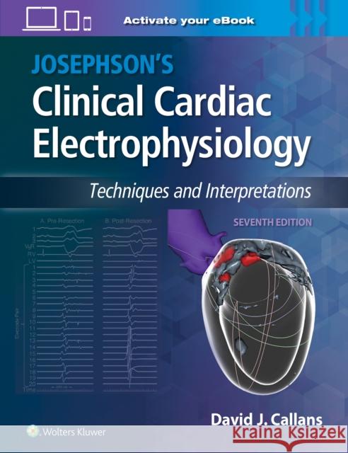 Josephson's Clinical Cardiac Electrophysiology Dr. David Callans 9781975201166 Wolters Kluwer Health