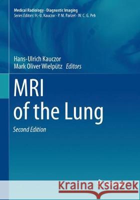 MRI of the Lung Hans-Ulrich Kauczor Mark Oliver Wielputz 9783030132552
