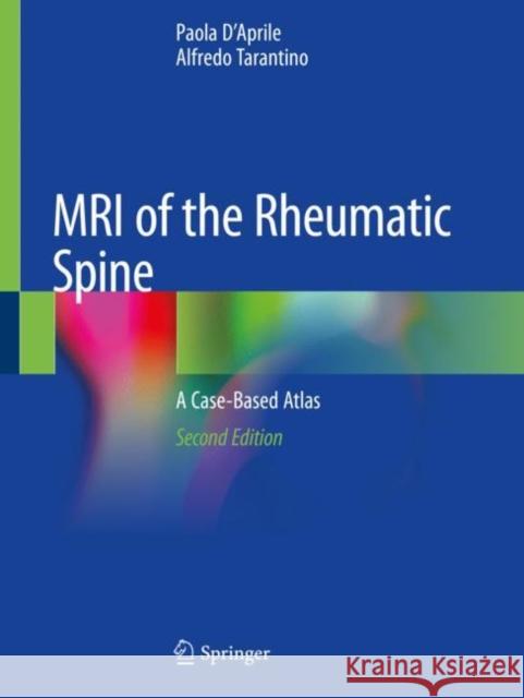MRI of the Rheumatic Spine: A Case-Based Atlas Paola D'Aprile Alfredo Tarantino 9783030329983 Springer