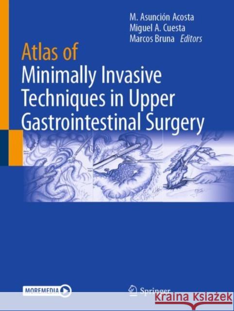 Atlas of Minimally Invasive Techniques in Upper Gastrointestinal Surgery Asunci Miguel a. Cuesta Marcos Bruna 9783030551759