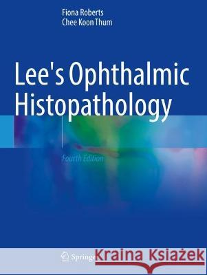 Lee's Ophthalmic Histopathology Roberts, Fiona, Chee Koon Thum 9783030765279