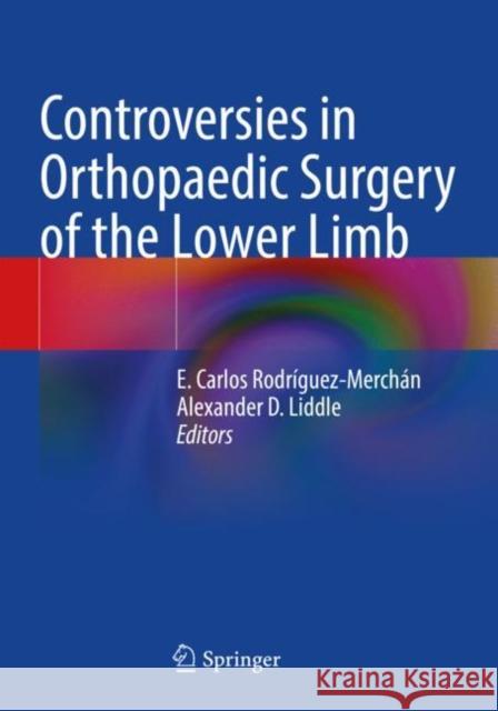 Controversies in Orthopaedic Surgery of the Lower Limb E. Carlos Rodr?guez-Merch?n Alexander D. Liddle 9783030806972 Springer