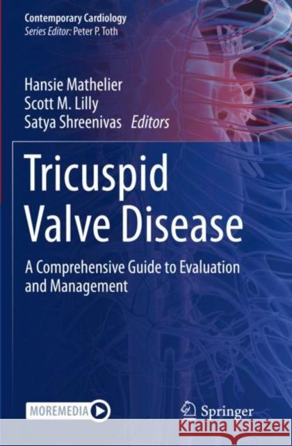 Tricuspid Valve Disease: A Comprehensive Guide to Evaluation and Management Hansie Mathelier Scott M. Lilly Satya Shreenivas 9783030920487 Springer