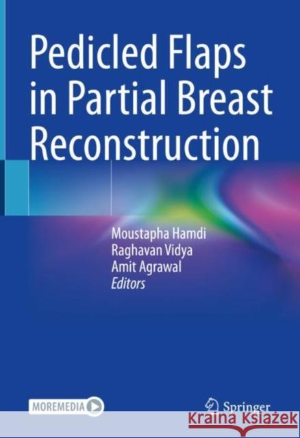 Pedicled Flaps in Partial Breast Reconstruction Moustapha Hamdi Raghavan Vidya Amit Agrawal 9783031084829