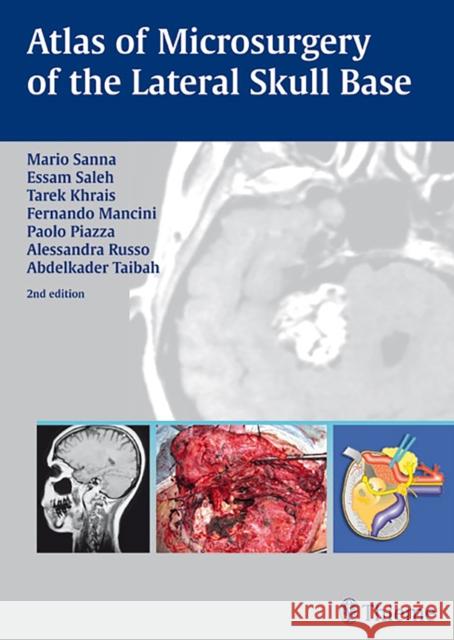 Atlas of Microsurgery of the Lateral Skull Base Sanna, Mario Saleh, Essam Khrais, Tarek  9783131010926 Thieme, New York