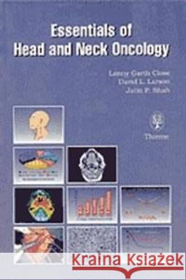 Essentials of Head and Neck Oncology L.Garth Close etc.  9783131105219 Thieme Publishing Group