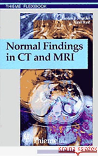 Normal Findings in CT and Mri, A1, Print Möller, Torsten Bert 9783131165213 Thieme Publishing Group