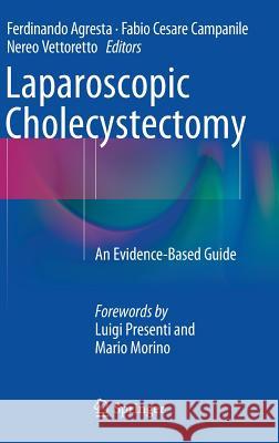 Laparoscopic Cholecystectomy: An Evidence-Based Guide Agresta, Ferdinando 9783319054063 Springer