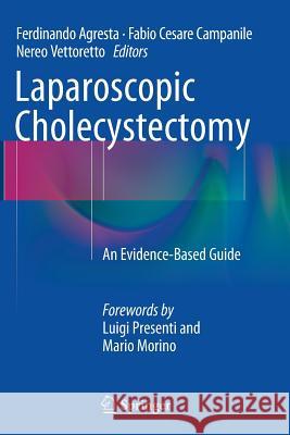 Laparoscopic Cholecystectomy: An Evidence-Based Guide Agresta, Ferdinando 9783319351919 Springer