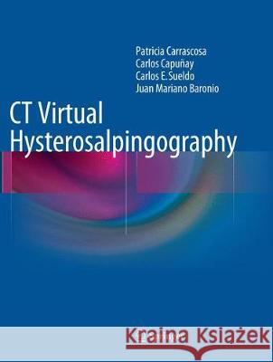 CT Virtual Hysterosalpingography Patricia Carrascosa Carlos Capunay Carlos E. Sueldo 9783319355412