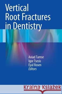 Vertical Root Fractures in Dentistry Aviad Tamse Igor Tsesis Eyal Rosen 9783319356358 Springer