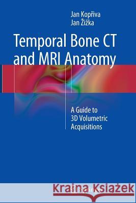 Temporal Bone CT and MRI Anatomy: A Guide to 3D Volumetric Acquisitions Kopřiva, Jan 9783319361604 Springer
