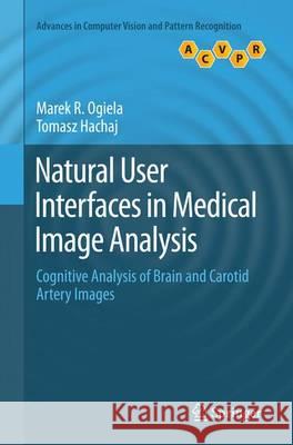Natural User Interfaces in Medical Image Analysis: Cognitive Analysis of Brain and Carotid Artery Images Ogiela, Marek R. 9783319377001