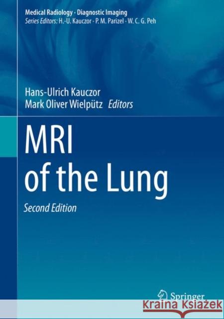 MRI of the Lung Hans-Ulrich Kauczor Mark Oliver Wielputz 9783319426167