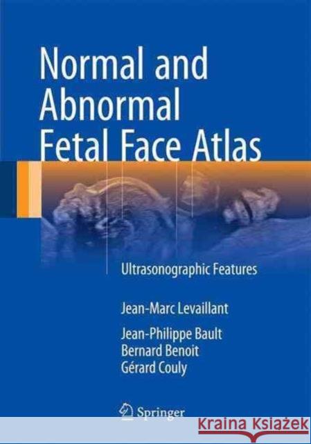Normal and Abnormal Fetal Face Atlas: Ultrasonographic Features Levaillant, Jean-Marc 9783319437682
