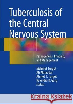 Tuberculosis of the Central Nervous System: Pathogenesis, Imaging, and Management Turgut, Mehmet 9783319507118