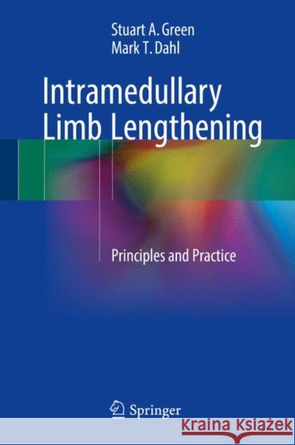 Intramedullary Limb Lengthening: Principles and Practice Green, Stuart A. 9783319602967