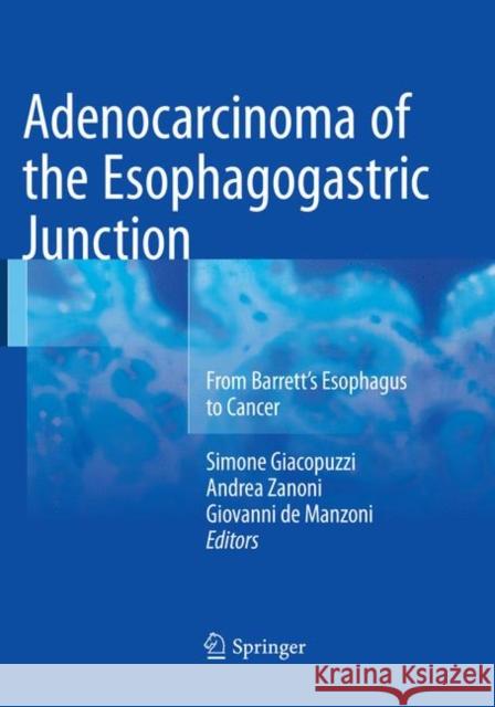 Adenocarcinoma of the Esophagogastric Junction: From Barrett's Esophagus to Cancer Giacopuzzi, Simone 9783319804217 Springer