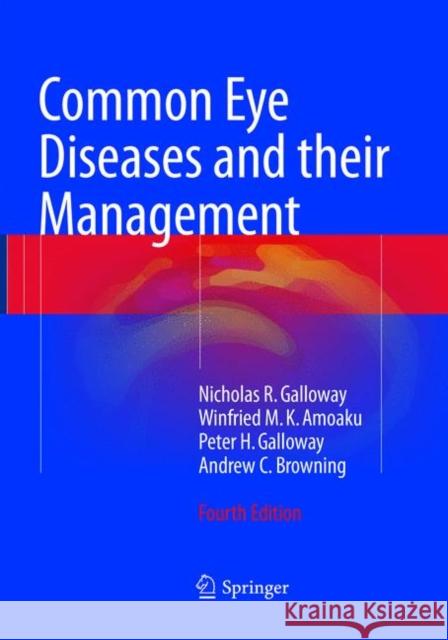Common Eye Diseases and Their Management Galloway, Nicholas R. 9783319813882 Springer
