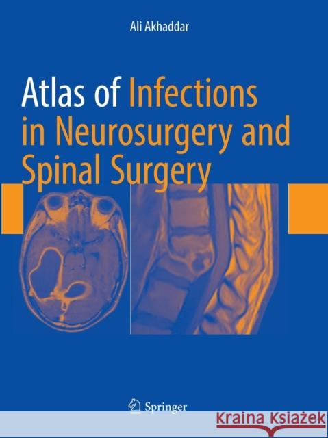 Atlas of Infections in Neurosurgery and Spinal Surgery Akhaddar, Ali 9783319867731