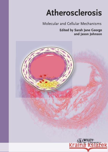 Atherosclerosis: Molecular and Cellular Mechanisms George, Sarah Jane 9783527324484