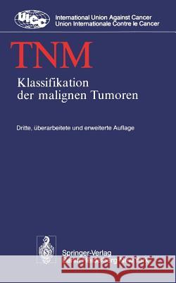 TNM: Klassifikation der malignen Tumoren B. Spiessl, O. Scheibe, G. Wagner 9783540090243 Springer-Verlag Berlin and Heidelberg GmbH & 