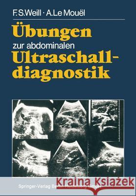 Übungen Zur Abdominalen Ultraschalldiagnostik Weill, F. S. 9783540131298 Not Avail