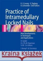 Practice of Intramedullary Locked Nails: New Developments in Techniques and Applications Alt, Volker 9783540253495 Springer