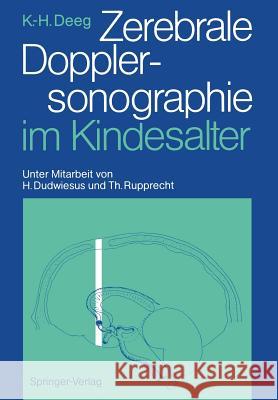 Zerebrale Dopplersonographie im Kindesalter Karl-Heinz Deeg, Heiko Dudwiesus, Thomas Rupprecht 9783540509134 Springer-Verlag Berlin and Heidelberg GmbH & 