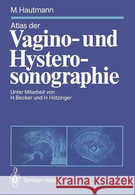 Atlas Der Vagino- Und Hysterosonographie Becker, Hermann 9783540510017