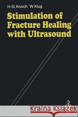 Stimulation of Fracture Healing with Ultrasound Hans Georg Knoch Winfried Klug T. C. Telger 9783540536741 Springer