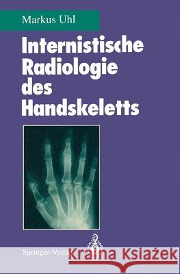 Internistische Radiologie Des Handskeletts Tauer, U. 9783540581918 Not Avail