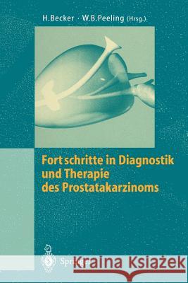 Fortschritte in Diagnostik Und Therapie Des Prostatakarzinoms Becker, Hermann 9783540591238