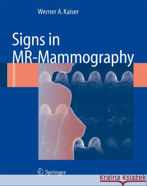 Signs in Mr-Mammography Kaiser, Werner A. 9783540732921 Not Avail