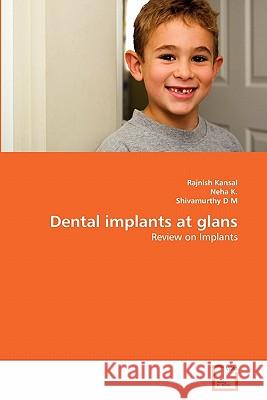 Dental implants at glans Kansal, Rajnish 9783639345612 VDM Verlag