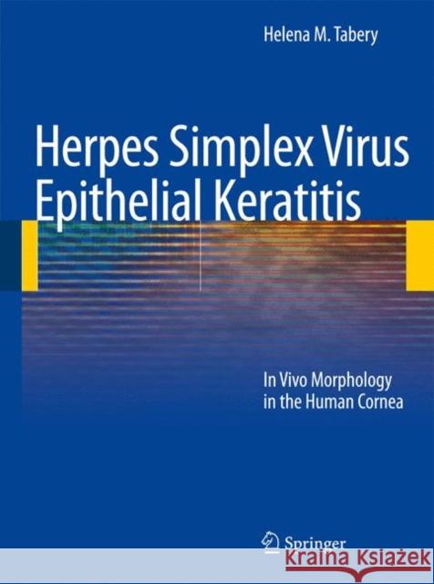 Herpes Simplex Virus Epithelial Keratitis: In Vivo Morphology in the Human Cornea Tabery, Helena M. 9783642010118 Springer