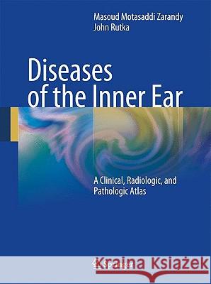 Diseases of the Inner Ear: A Clinical, Radiologic and Pathologic Atlas Motasaddi Zarandy, Masoud 9783642050572 Springer